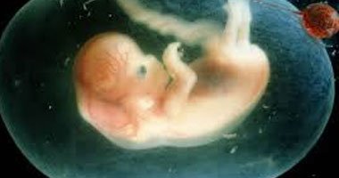 PENYALAHGUNAAN PERZINAAN MELALUI LEGALISASI ABORSI