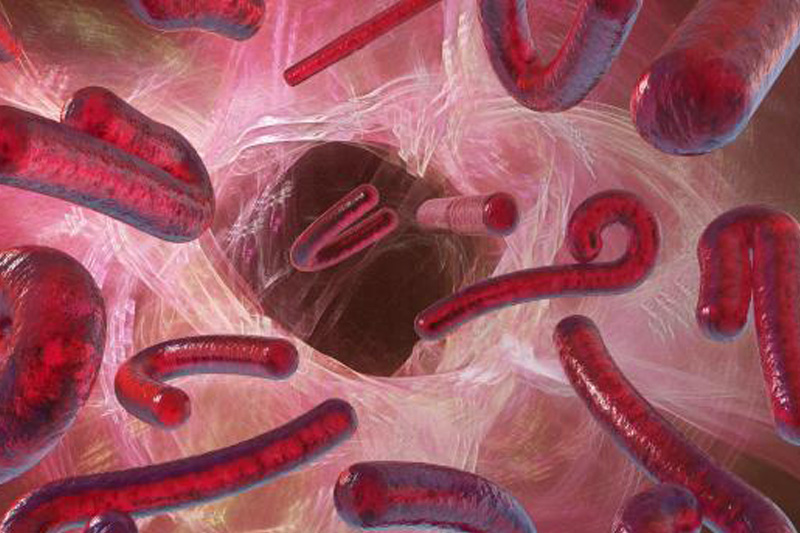 KONSPIRASI YAHUDI ATAS VIRUS MEMATIKAN (Virus Ebola, Flu Burung, Flu Babi)