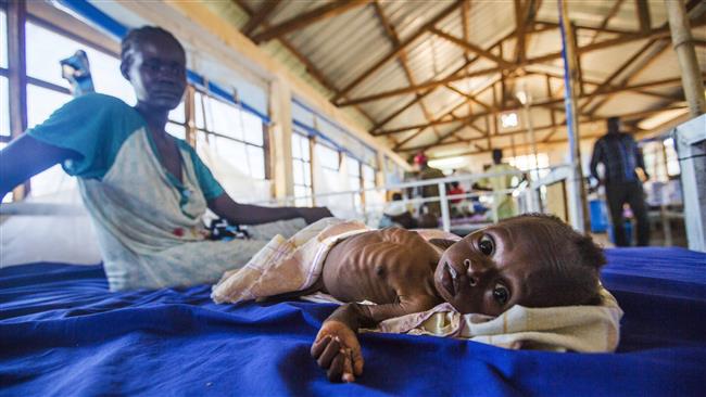 PBB Sedikitnya 40 000 Orang  Sekarat  Akibat Kelaparan Di 