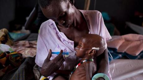 PBB Peringatkan Tingkat Kelaparan Mengkhawatirkan di Sudan Selatan