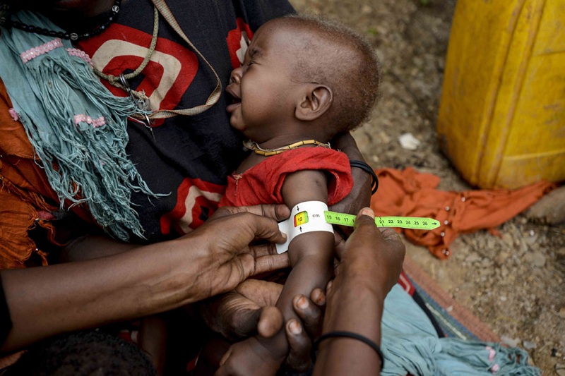 Sekjen PBB: Diperlukan Bantuan Atasi Krisis Kelaparan di Empat Negara