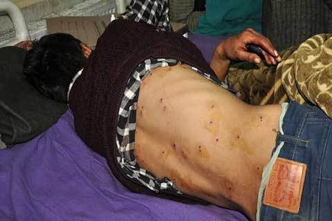 Tembakan Peluru Pelet Buat Dua Pemuda Kashmir Kritis