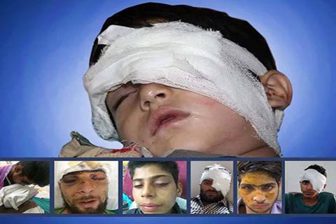 Korban Peluru Pelet di Kashmir Diupayakan Dapat Santunan