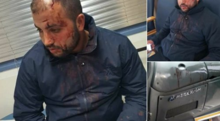 Sopir Bus Palestina Luka Diserang Kelompok Pemukim Yahudi