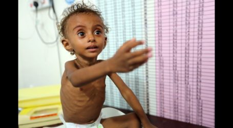 WHO: 75 Persen Anak di Yaman Kekurangan Gizi Akut