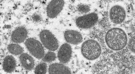 Prancis, Jerman, Belgia Laporkan Kasus Pertama Virus Cacar Monyet