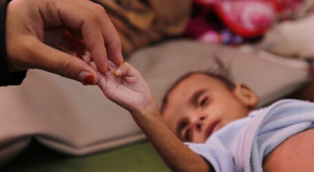 PBB: Lebih dari 11.000 Anak Tewas atau Cacat dalam Perang Yaman