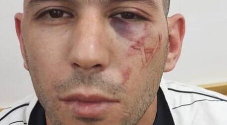 Polisi Israel Dipanggil karena Ada Cap ‘Bintang Daud’ di Wajah Warga Palestina